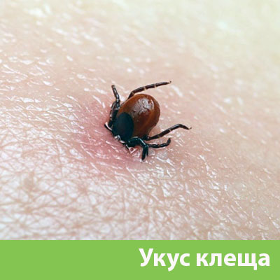 Укус клеща в Астрахани